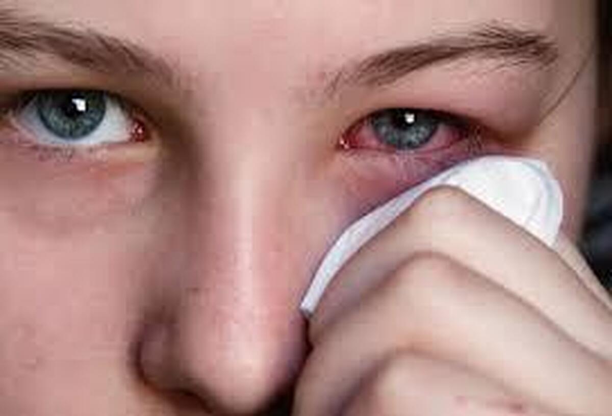 چرا چشم‌ها در پاییز حساس‌تر می‌شوند؟؛ بررسی دلایل و راهکارها