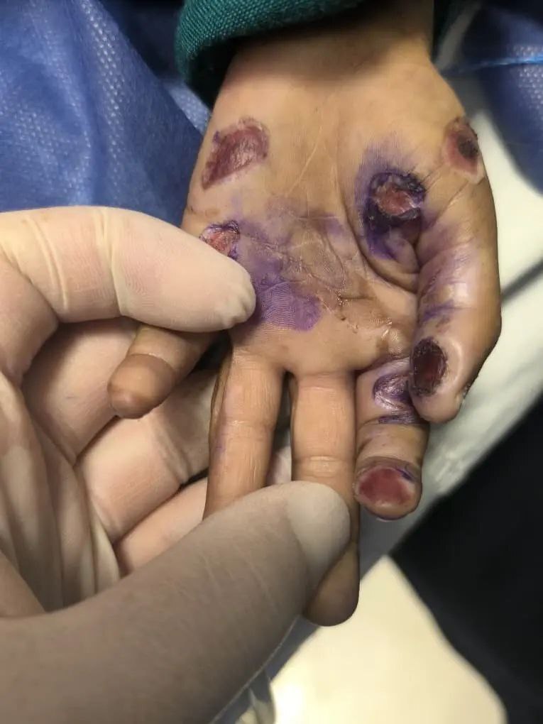 فوت دردناک یک کودک ۴ساله در پی آزار و اذیت + عکس فوت دردناک یک کودک ۴ساله در پی آزار و اذیت + عکس