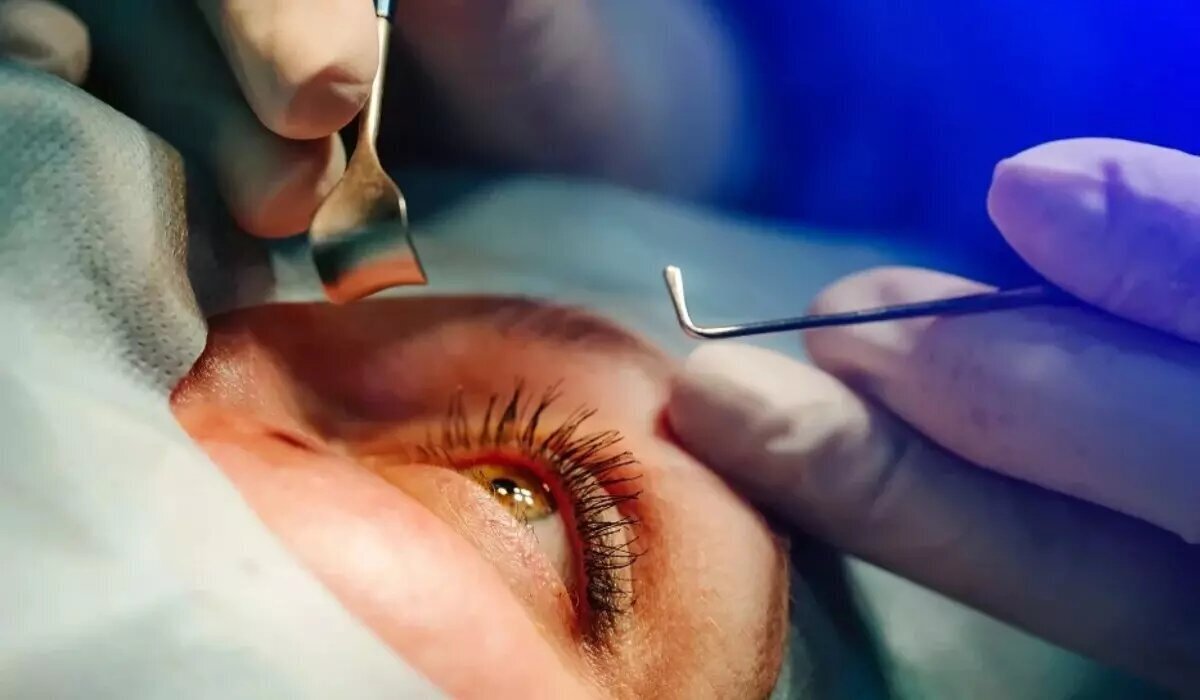 شیوع قوز قرنیه در ایران بالاتر از جهان | این عوامل باعث نابینایی شما می‌شوند