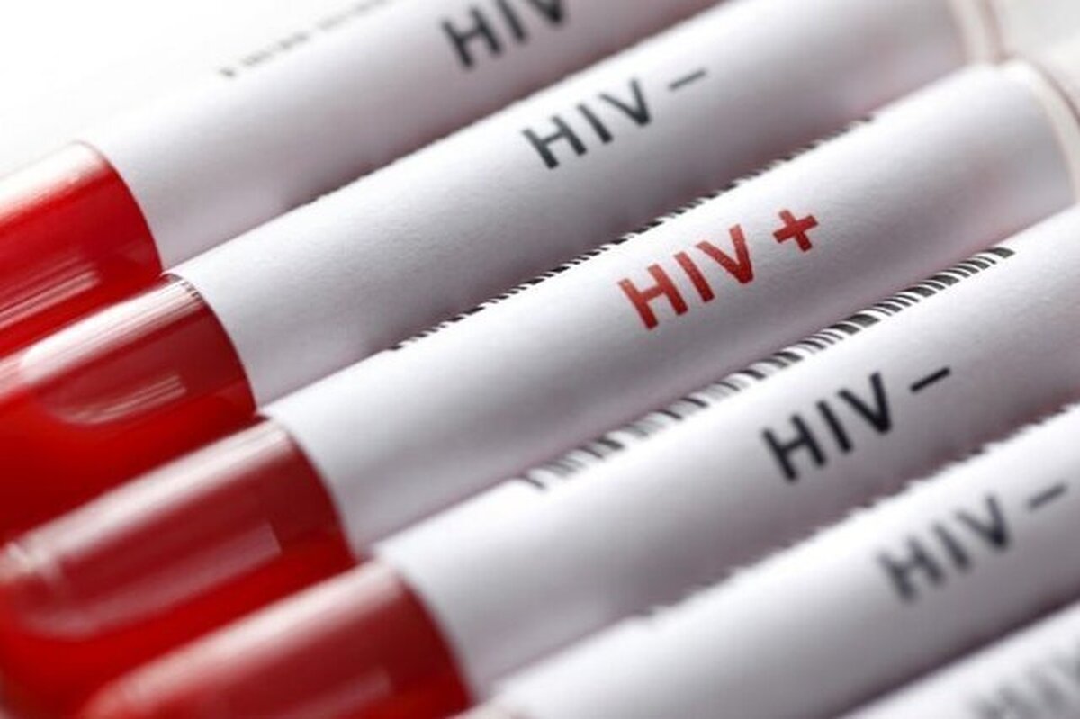 آغاز پویش «من هم تست HIV می‌دهم» از امروز تا ۲۰ آذرماه