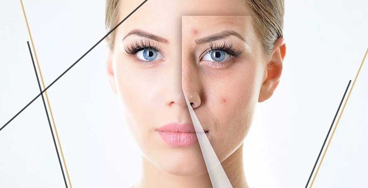 با رعایت این موارد پوست شما در زمستان مثل آینه می درخشد