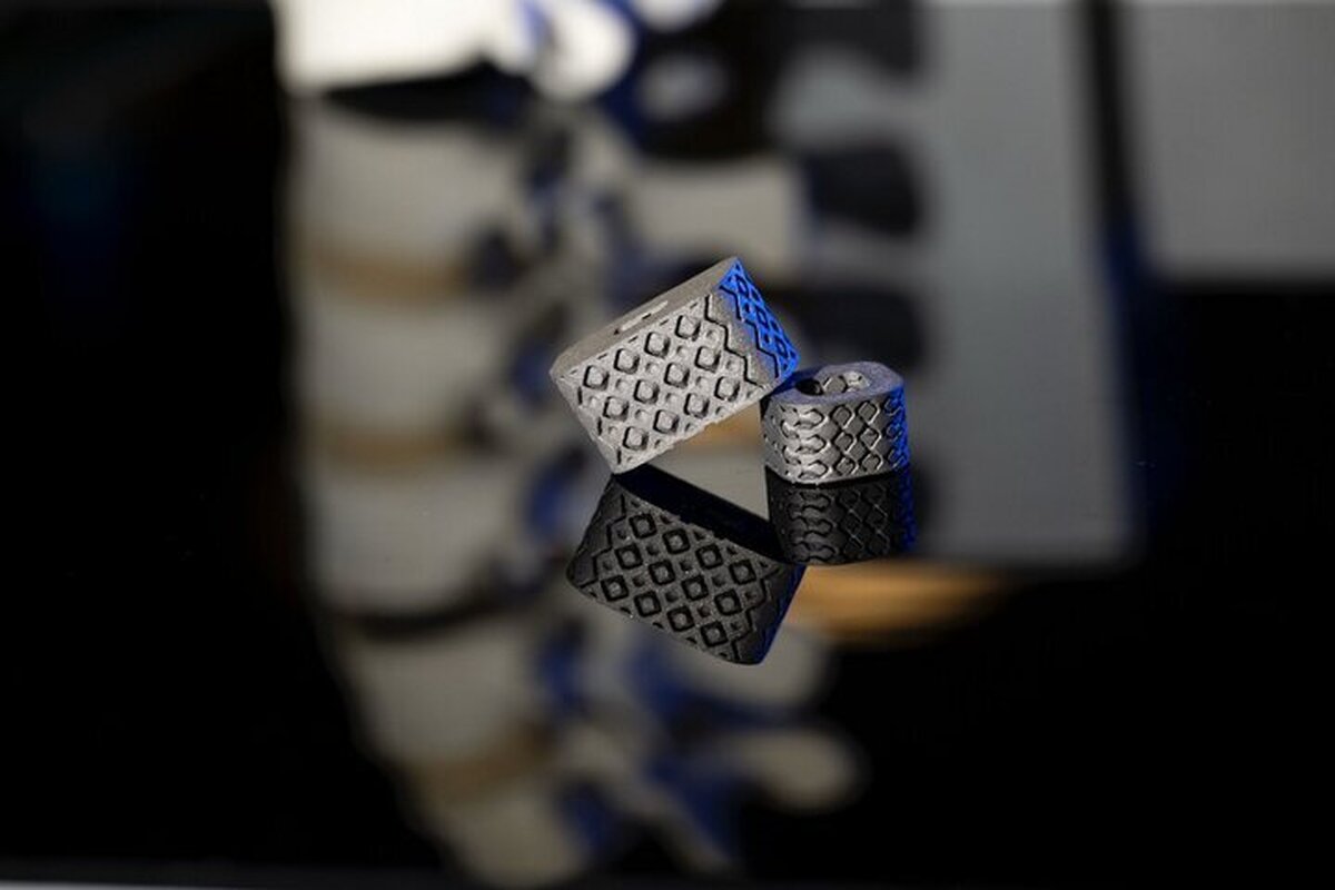 ایمپلنتی که وضعیت ستون فقرات را از درون بدن گزارش می‌کند