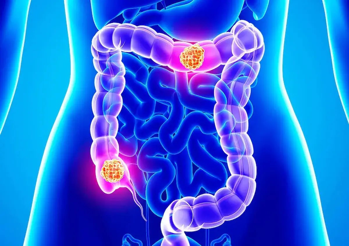 این نوع شیر روده های شما را فول انرژی می کند
