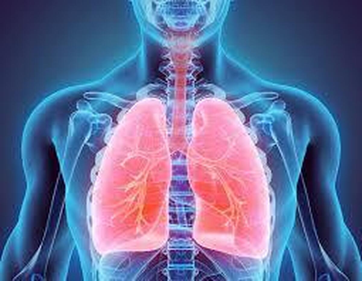 2 عامل اصلی برای ابتلا و تشدید بیماری‌های انسدادی مزمن ریوی