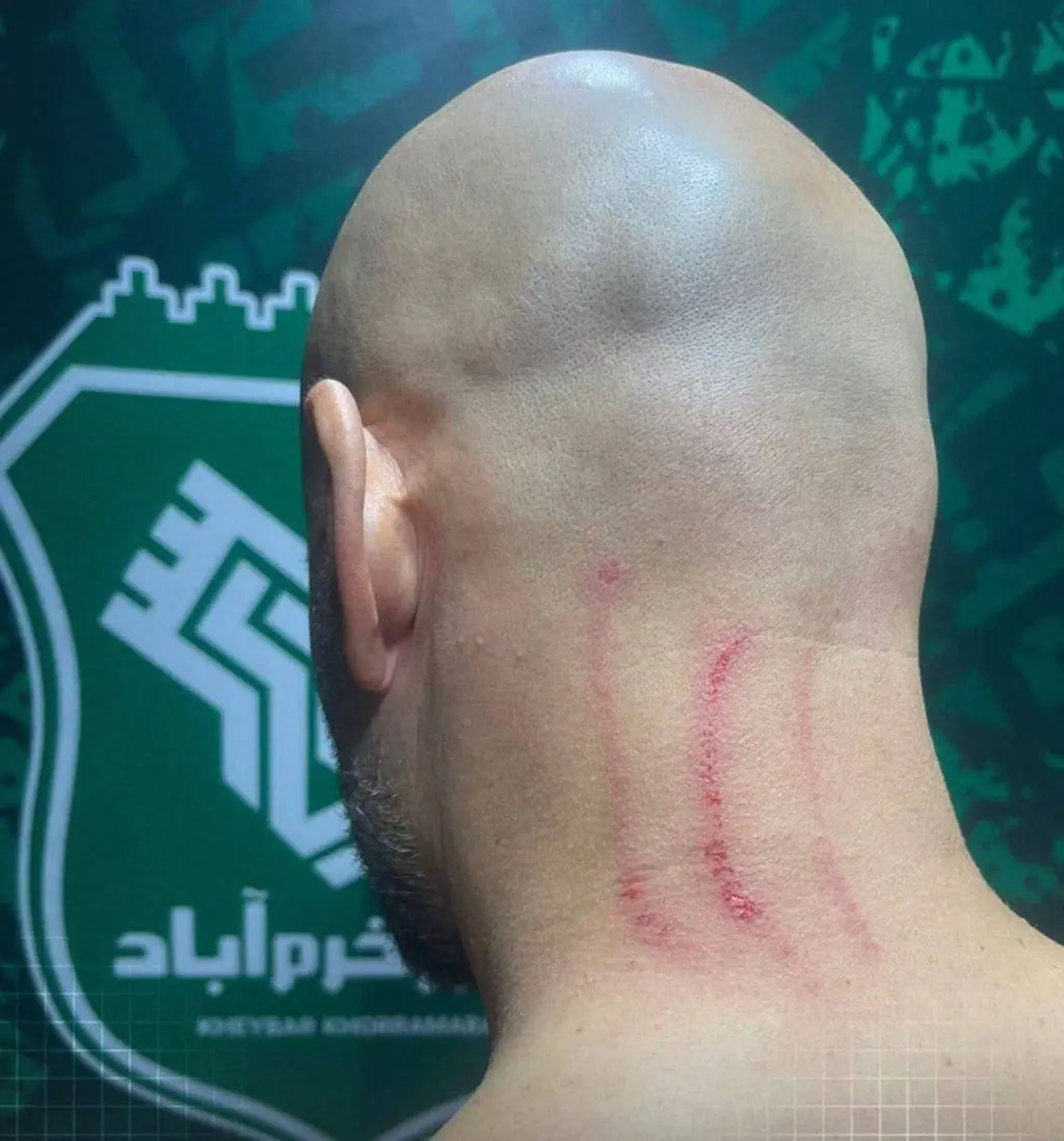 عکس|حمله وحشیانه به ساپینتو و پژمان ماندگاری عکس|حمله وحشیانه به ساپینتو و پژمان ماندگاری