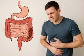 اگر روده شما هم خوب کار نمی کند بخوانید