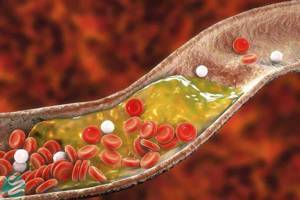 چرا باید از ۲۵ سالگی مراقب کلسترول خون خود باشیم؟