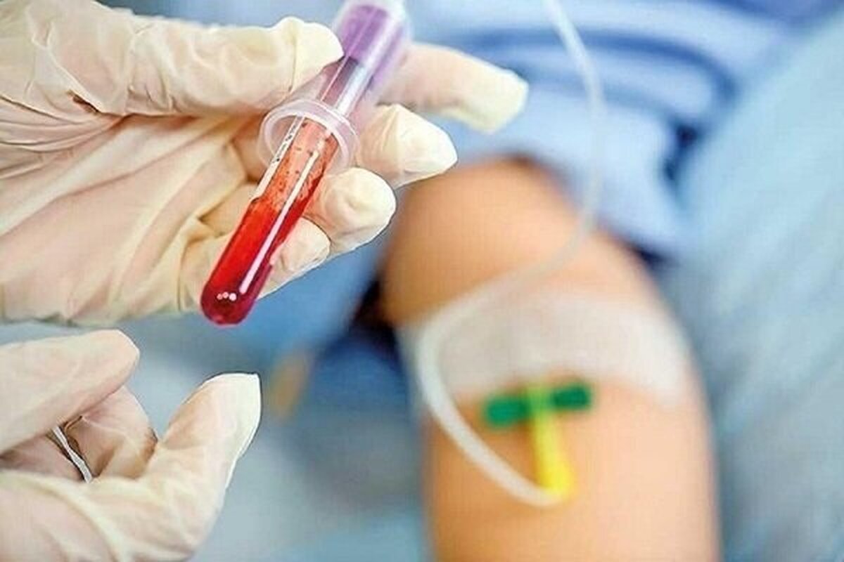 کشف بیماری جدید بنام SMS