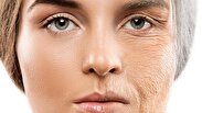 پوست شما چند ساله است؟ | ۳ عادت روزانه برای جوان نگه داشتن آن