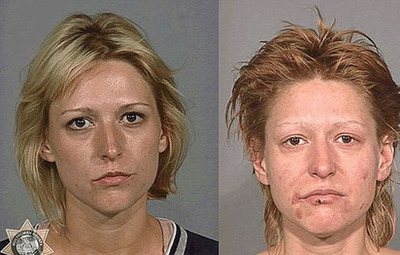 تاثیرات مصرف شیشه بعد از یک سال و نیم