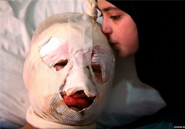 انفجار خودروی بمب‌گذاری شده در مرز لبنان و سوریه