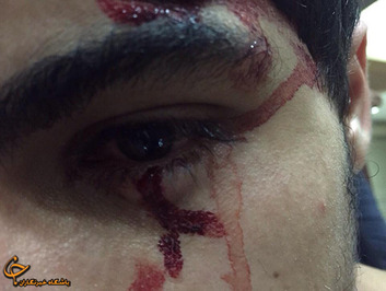 از زحمی شدگان اعتراضات شب گذشته بحرین