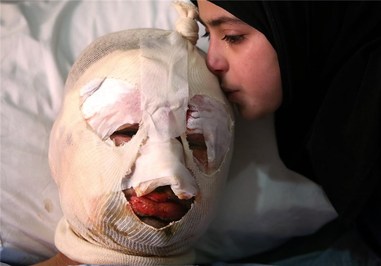 زخمیهای ناشی از بمبگذاری در مرز لبنان و سوریه