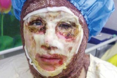 سریال اسیدپاشی های اصفهان نگرانی های زیادی را از بابت باب شدن این موضوع میان مردم به وجود آورد.