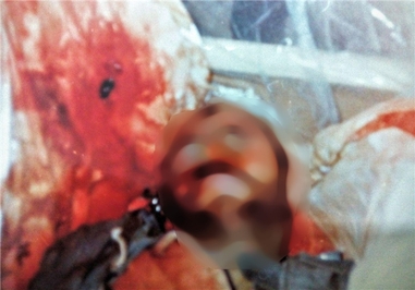 چهره شهید احدالله محسنی به احترام خانواده این شهید عزیز، محو گردید