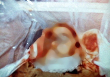 چهره شهید حشمت الله «بهروز» محسنی به احترام خانواده این شهید عزیز، محو گردید