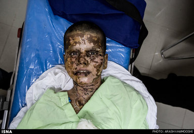 محمدهادی ۱۲ ساله، اسفند ماه ۱۳۹۳ هنگام بازگشت از مدرسه در منطقه مرزی مهران روی مین رفت و پس از 20 روز بستری بودن در بیمارستان اهواز، در گذشت. این عکس ۲۴ ساعت پیش از مرگ محمدهادی، از او گرفته شده است.