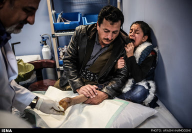 پزشک به کمک پدر گشین در حال خارج کردن پلاتین از پای اوست. پای گشین که در پی انفجار مین قطع شده، تاکنون سه بار تحت عمل جراحی قرار گرفته است.