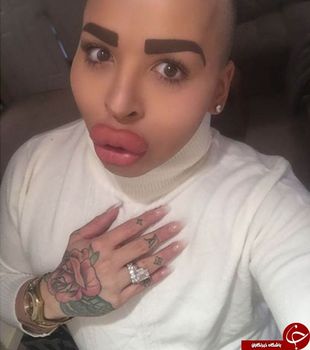 جوردن پارک پس از جراحی پلاستیک