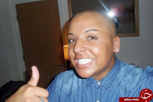 جوردن پارک قبل از جراحی