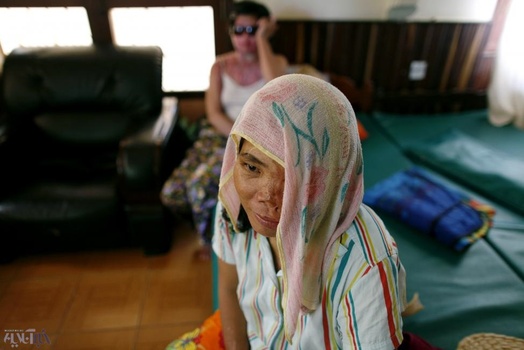 قربانی اسیدپاشی در کامبوج