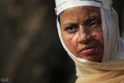 قربانی اسیدپاشی در بنگلادش
