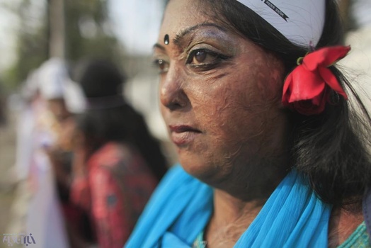 قربانی اسیدپاشی در بنگلادش