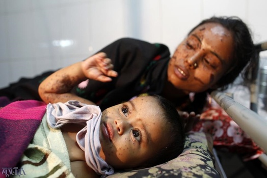 قربانی اسیدپاشی و فرزند 11 ماههاش در بنگلادش