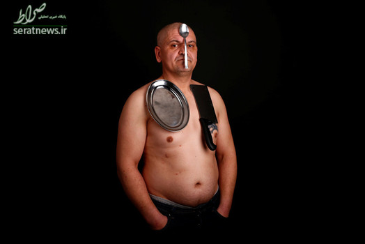 بدن این مرد اهل بوسنی به شکل عجیبی توانایی جذب ظروف آشپزخانه، وسایل پلاستیکی و تلفن همراه را دارد