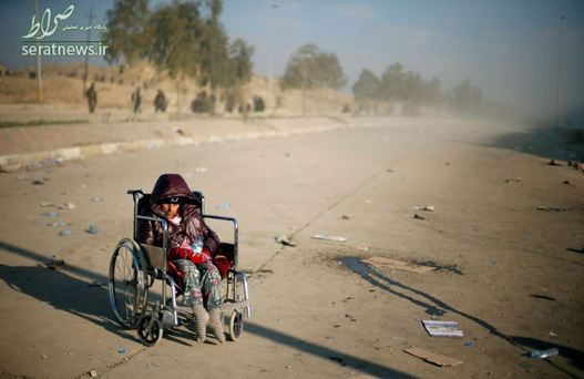دختر معلول عراقی در غرب موصل