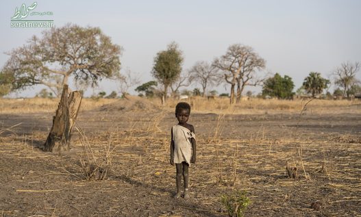 یک پسر قحطی زده در سودان جنوبی