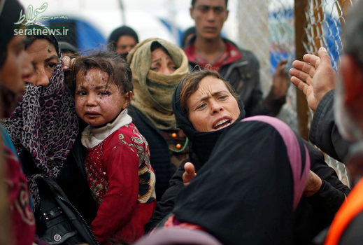 چهره زخمی دختربچه آواره عراقی در جنوب موصل