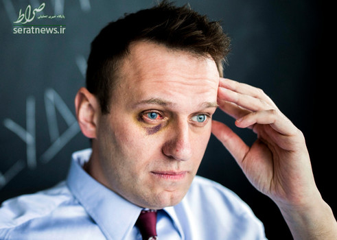 چشم آسیب دیده الکسی ناوالنی رهبر مخالفان روسیه در دفتر خود در مسکو