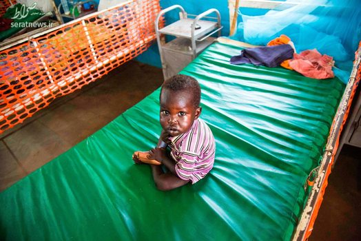 یک کودک دچار سوءتغذیه بر روی یک تخت در کلینیکی در سودان جنوبی
