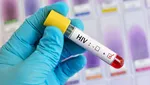 آنچه بیماران HIV باید قبل از مراجعه به دندان‌پزشک بدانند