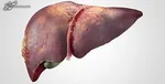 قهوه ریسک آسیب کبدی را در افراد دیابتی کاهش می‌دهد