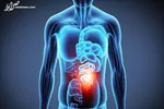 آیا رژیم‌های کم چرب عمر افراد مسن را طولانی‌تر می‌کنند؟