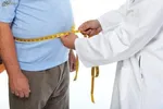 تاثیر داروهای کاهش وزن در تسکین میگرن مزمن