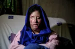 دختران کم سن و سال قربانی اسیدپاشی +تصاویر(18+)