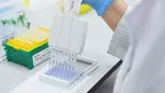 ویرایش ژن‌ها راهی برای پیشگیری از بیماری آلزایمر