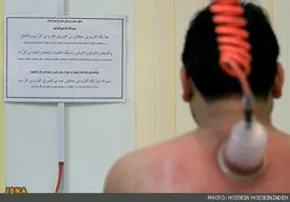 فیلم / نحوه رفع جای جوش صورت