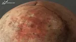 کاشت ناخن دشمن دوست نمای ناخن‌های شما