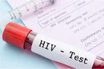 ورود عفونت HIV به خانواده‌ها زنگ خطر است