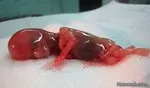 زایمان طبیعی ایمن‌ترین روش زایمان در دنیا | آمار سقط‌های غیرقانونی در کشور