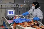 محققان یک گام نزدیک‌تر به واکسن موثر HIV