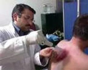 فیلم / نحوه رفع جای جوش صورت