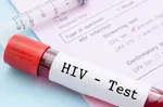 آنچه بیماران HIV باید قبل از مراجعه به دندان‌پزشک بدانند