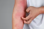 ۸ نشانه‌ اولیه سکته قلبی