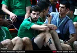 روش‌عجیب برای پاک‌کردن خالکوبی+تصاویر