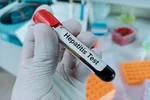 پایان مهلت ۱۰۰ بیمارستان دارای اخطار ایمنی